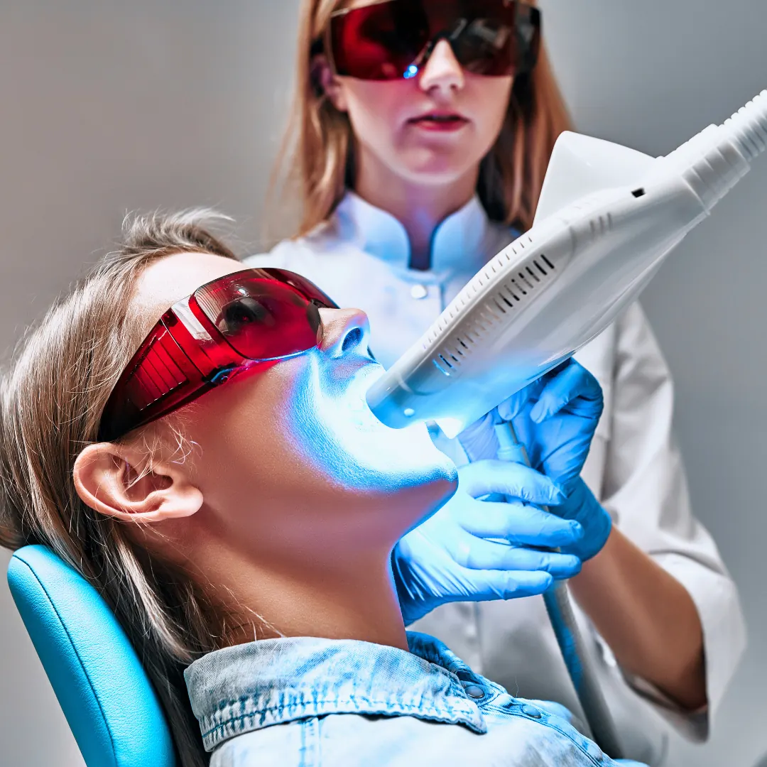 Whitening