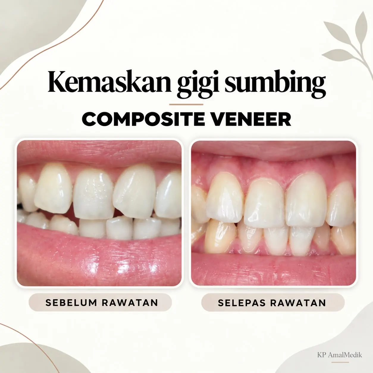 Poster scaling terbaru sebelum dan selepas